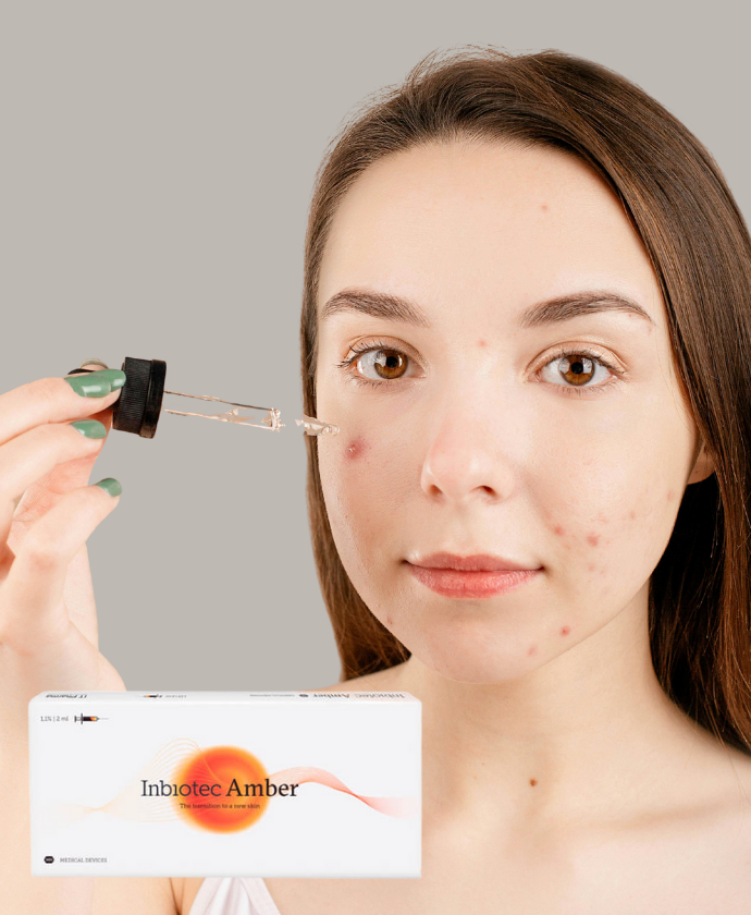 Imbotec Amber/Acné